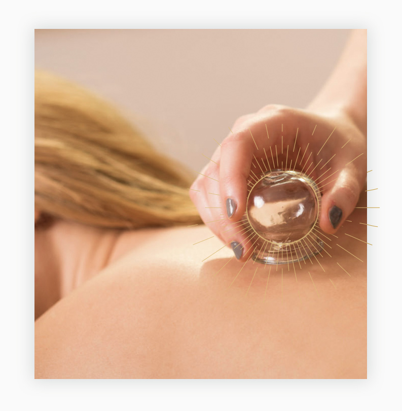 therapies_cupping